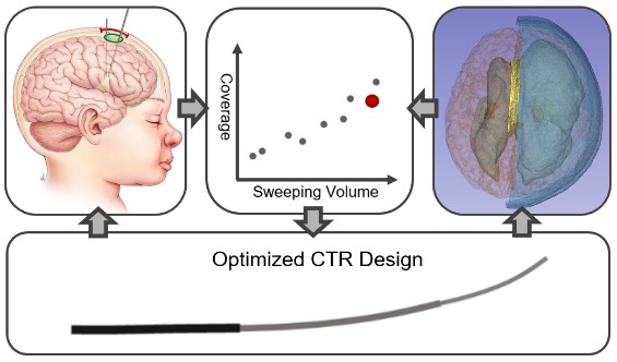 Concentric Tube Robot Optimization and Path Planning for Epilepsy Surgeries.
